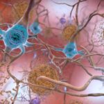 New Study Admits That COVID-19 Can Infect Brain Cells