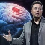 Musk: Robots Will Perform Brain Implant Surgery As Outpatient Procedure