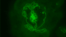 O imagine fluorescentă a unui organoid testicular creat din embrioni de șoarece și incubat într-un vas timp de 14 zile. Structurile tubulare formate în vas sunt clar vizibile. Marcate cu verde sunt celulele Sertoli, care sunt celulele responsabile de formarea tubilor din testicul și, într-adevăr, creează tubulii din vas. (CREDIT: Cheli Lev)